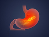 (Free and quiet) Probiotic solid drink (live bacteria type)
